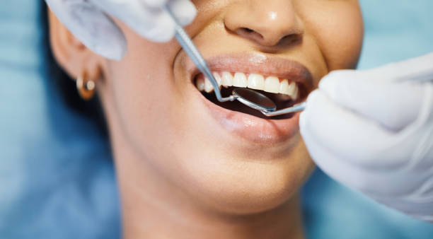 Best After-Hours Dental Care in Ball Pond, CT